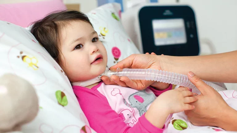 Criança traqueostomizada em uso de ventilador mecânico e assistente de tosse.