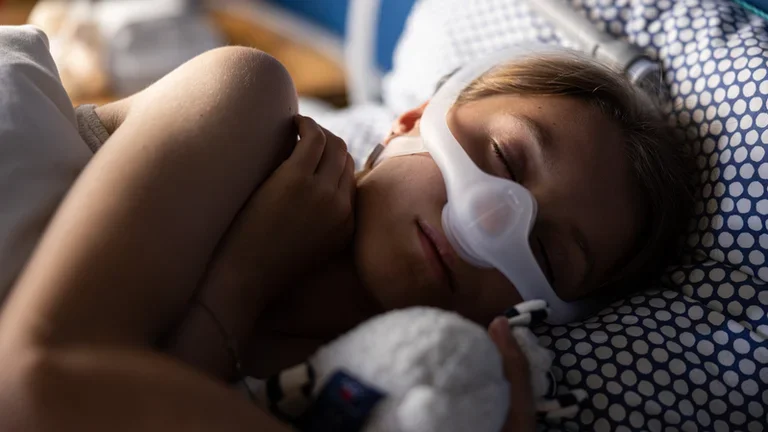 Obstructive sleep apnea in children - sleeping patient (girl) 2