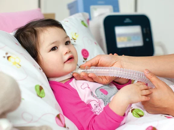 Criança traqueostomizada em uso de ventilador mecânico e assistente de tosse.