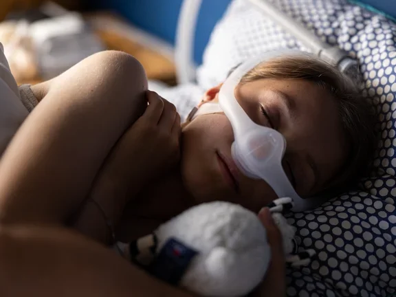 Obstructive sleep apnea in children - sleeping patient (girl) 2