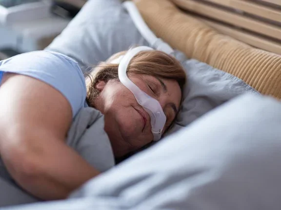 Obstructive sleep apnea in adults - sleeping patient (female)