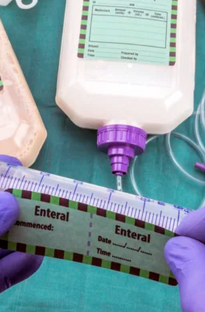 Profissional manipulando uma seringa apropriada para nutrição enteral