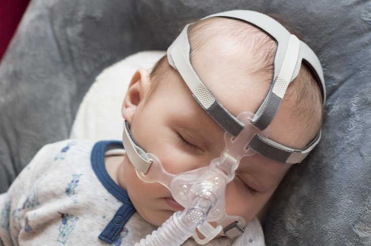 Bebê utilizando máscara nasal para ventilação mecânica