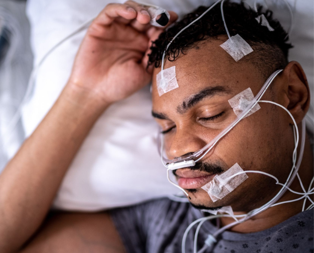 Homem dormindo durante o exame de polissonografia com os eletrodos, cânula nasal e termistor